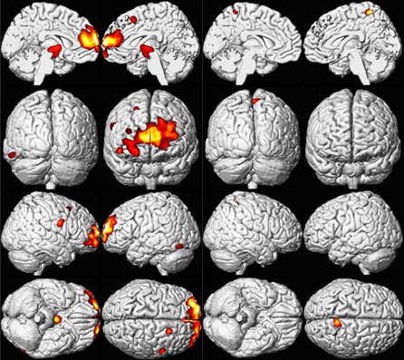 brains showing possible health effects