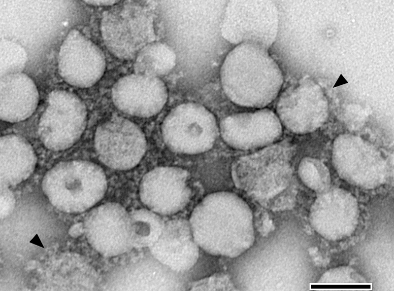 The coronavirus derives its name from the fact that under electron microscopic examination, each virion is surrounded by a “corona”, or halo. This is due to the presence of viral spike peplomers emanating from its proteinaceous envelope. SARS is one of the most infamous of the coronaviruses.
