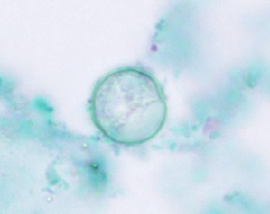 Micrograph showing circular oocysts of the parasite C. cayetanensis