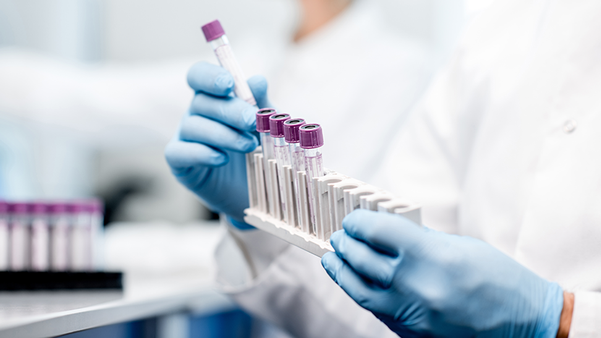 A technician removing a test tube from a test tube rack in a laboratory.