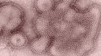 H3N2 variant influenza virus