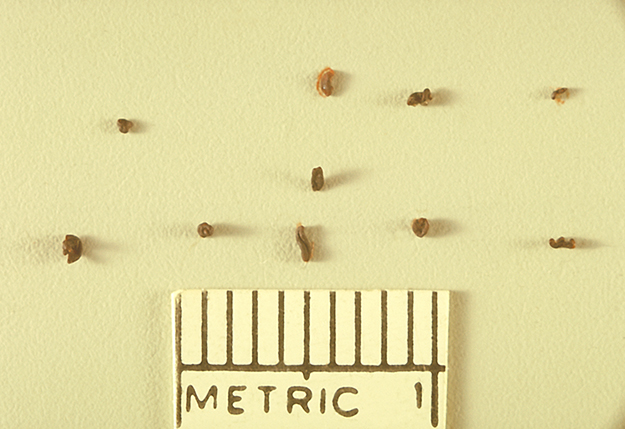 Various sized grains of the fungus Madurella grisea