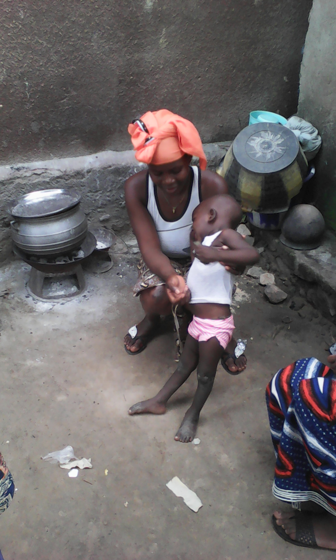 A child with polio and his mother in Mali