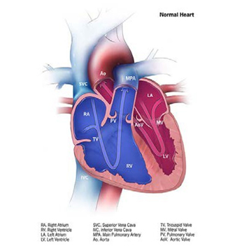 4.5f Tricuspid Valve Atresia, | CDC