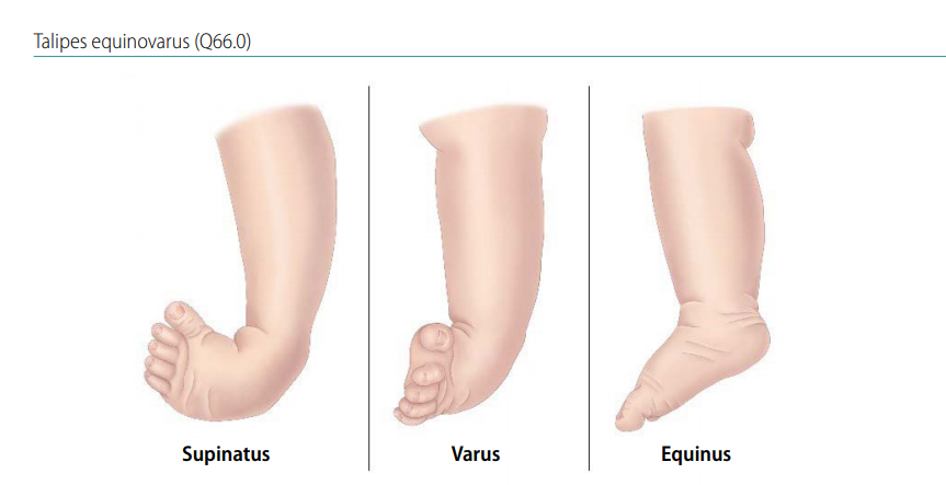 Fig. 4.34. Foot positions