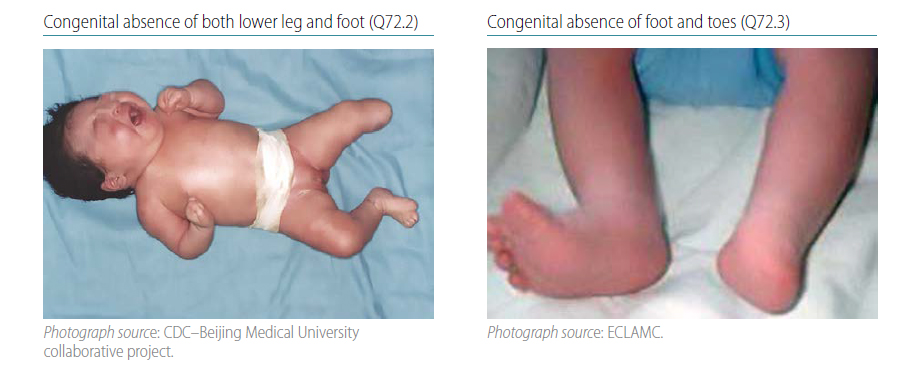 Fig. 4.37. Transverse terminal-pt2