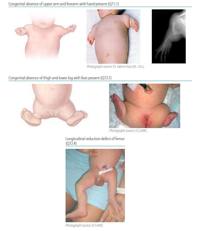 Fig. 4.38. Transverse intercalary