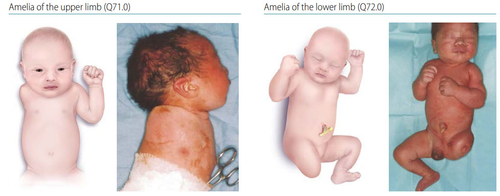 Fig. 36. Amelia