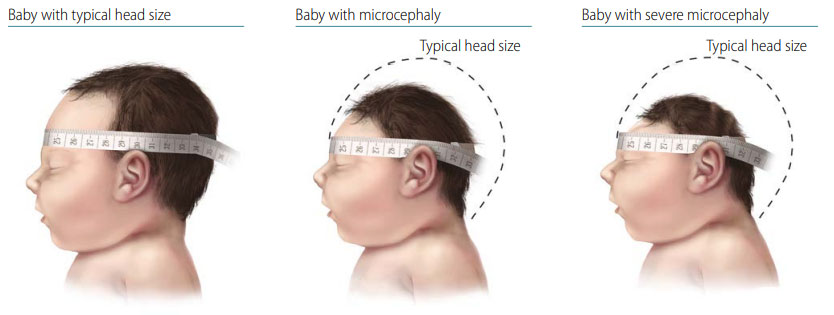 Fig. 12. Measurement of head size