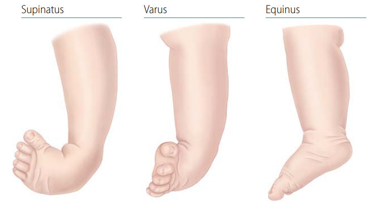 Additional visual: foot positions