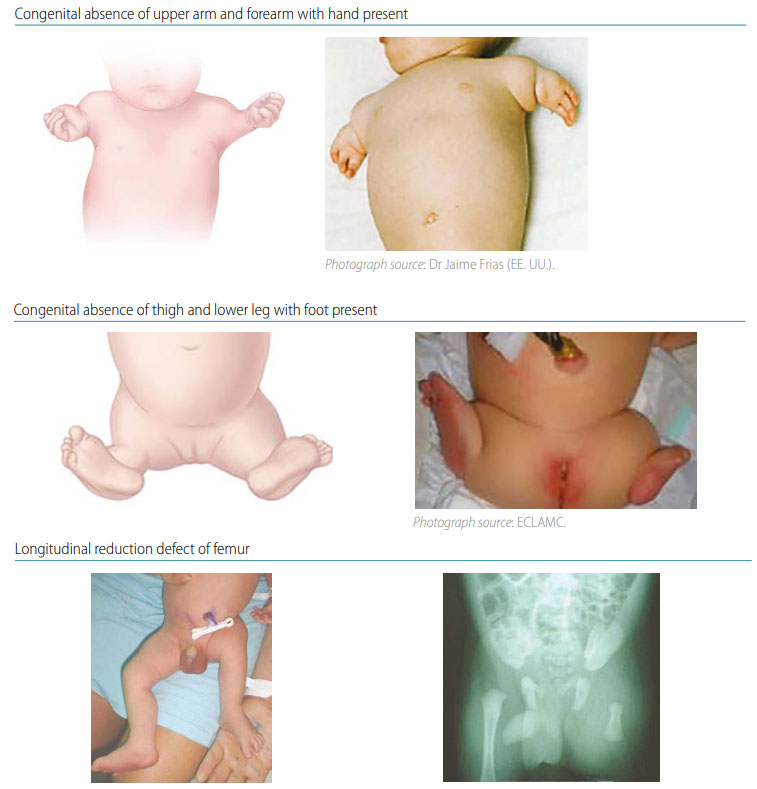 Fig. 40. Transverse intercalary