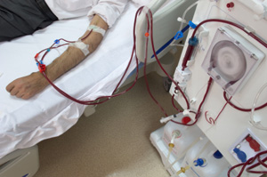 Hemodialysis Machine and Patient