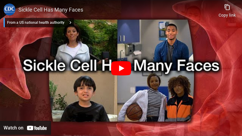 Sickle Cell Has Many Faces