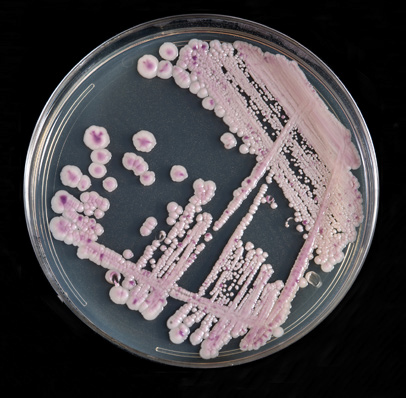 Candida auris, plated on Candida CHROMagar