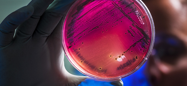 A scientist holding an infection in a dish