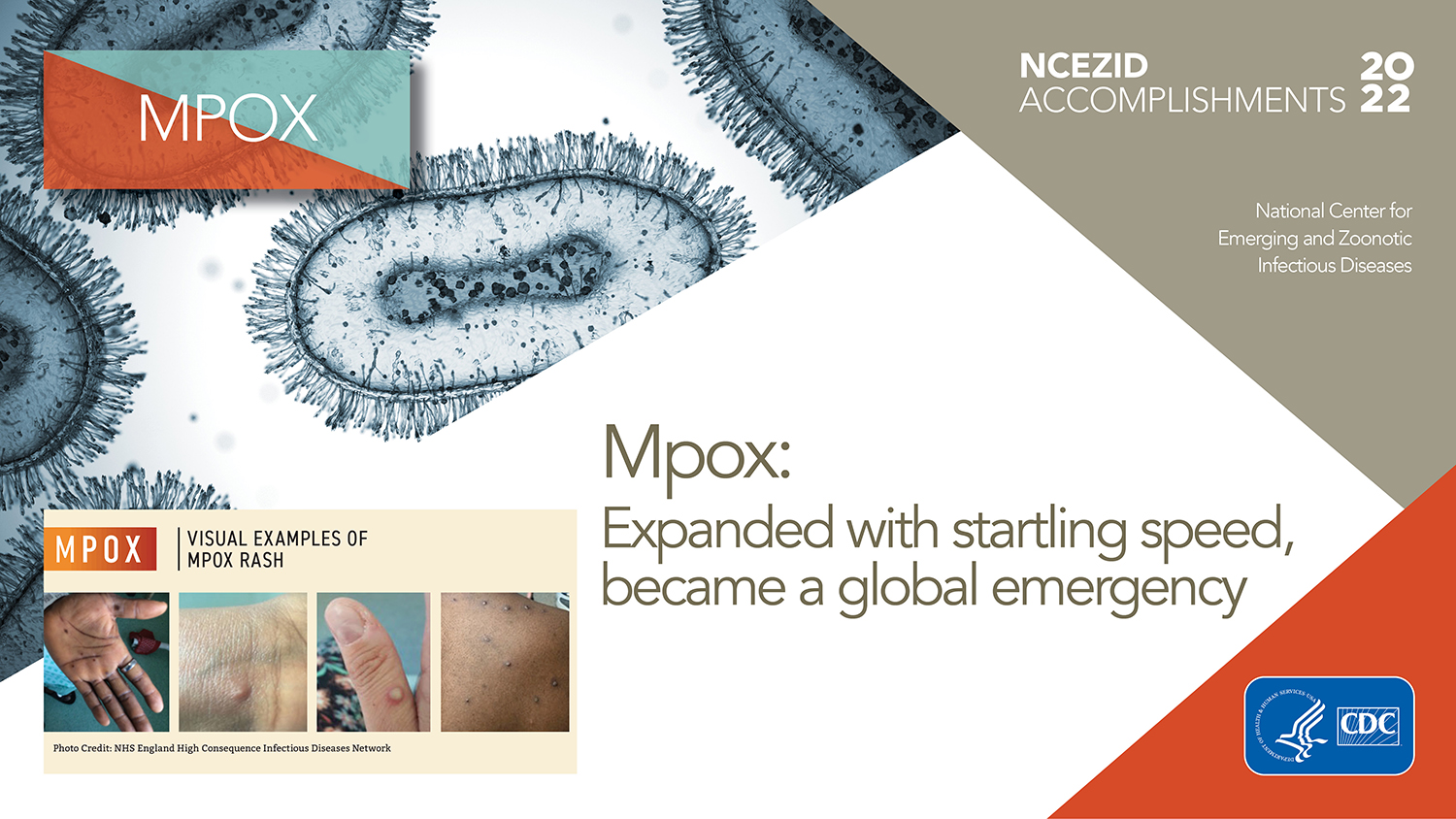 Twitter card for MPOX: Expanded with startling speed, became a global emergency