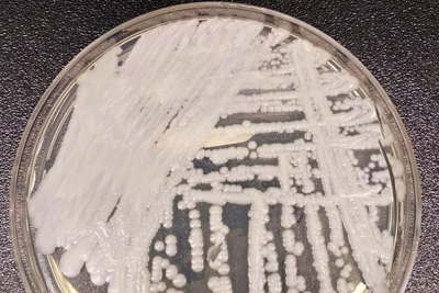 Petri dish with cultured candida auris