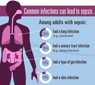 Cropped image from the sepsis fact sheet