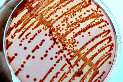 petri dish with red dots in smear pattern