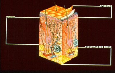 Slide 11 - Skin Cross Section