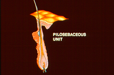 SLIDE 16 - Pilosebaceous Unit