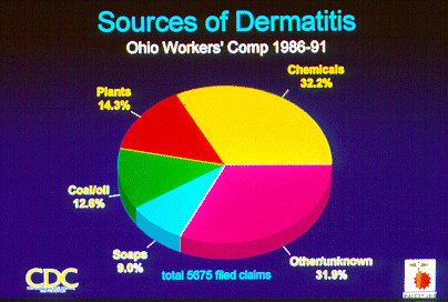 SLIDE 34 - Sources of Dermatitis