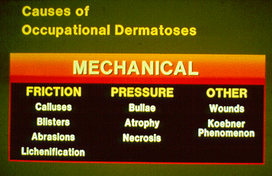 SLIDE 58 - Mechanical