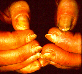 SLIDE 83 - Wet work, nails