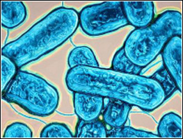 ORIGIN_img_LEGION2 Highly magnified photo of Legionnaire's Disease