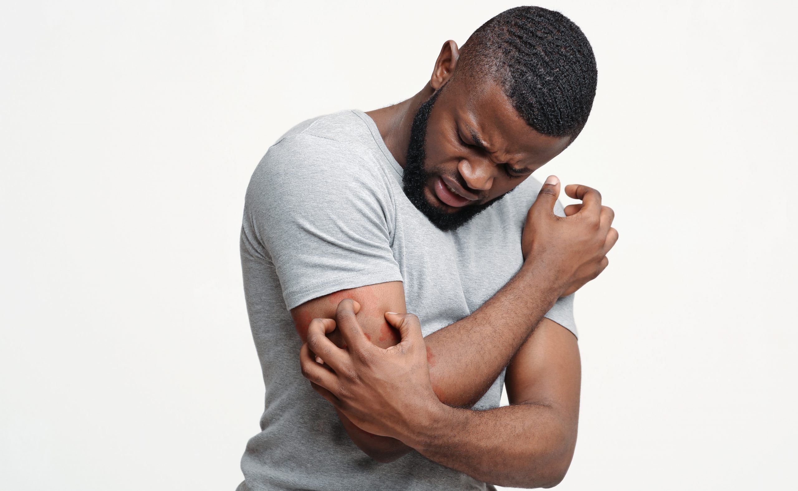 Young African-American man scratching his itching arm.