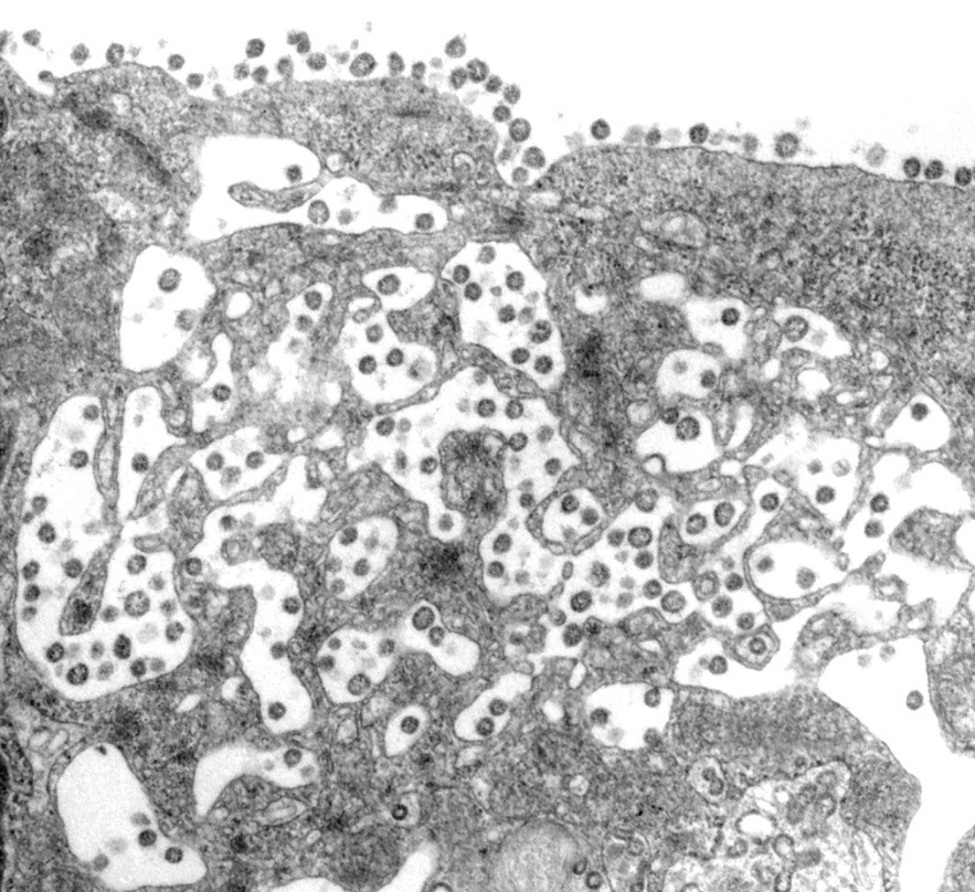 Image of SARS Coronavirus