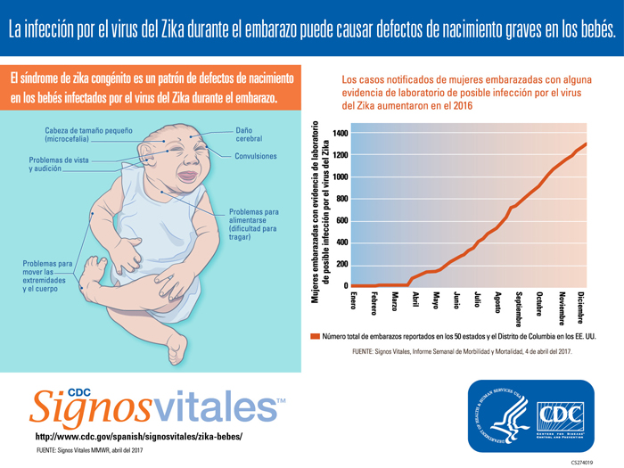 Infograf%26iacute;a: La infecci%26oacute;n por el virus del Zika durante el embarazo puede causar defectos de nacimiento graves en los beb%26eacute;s.