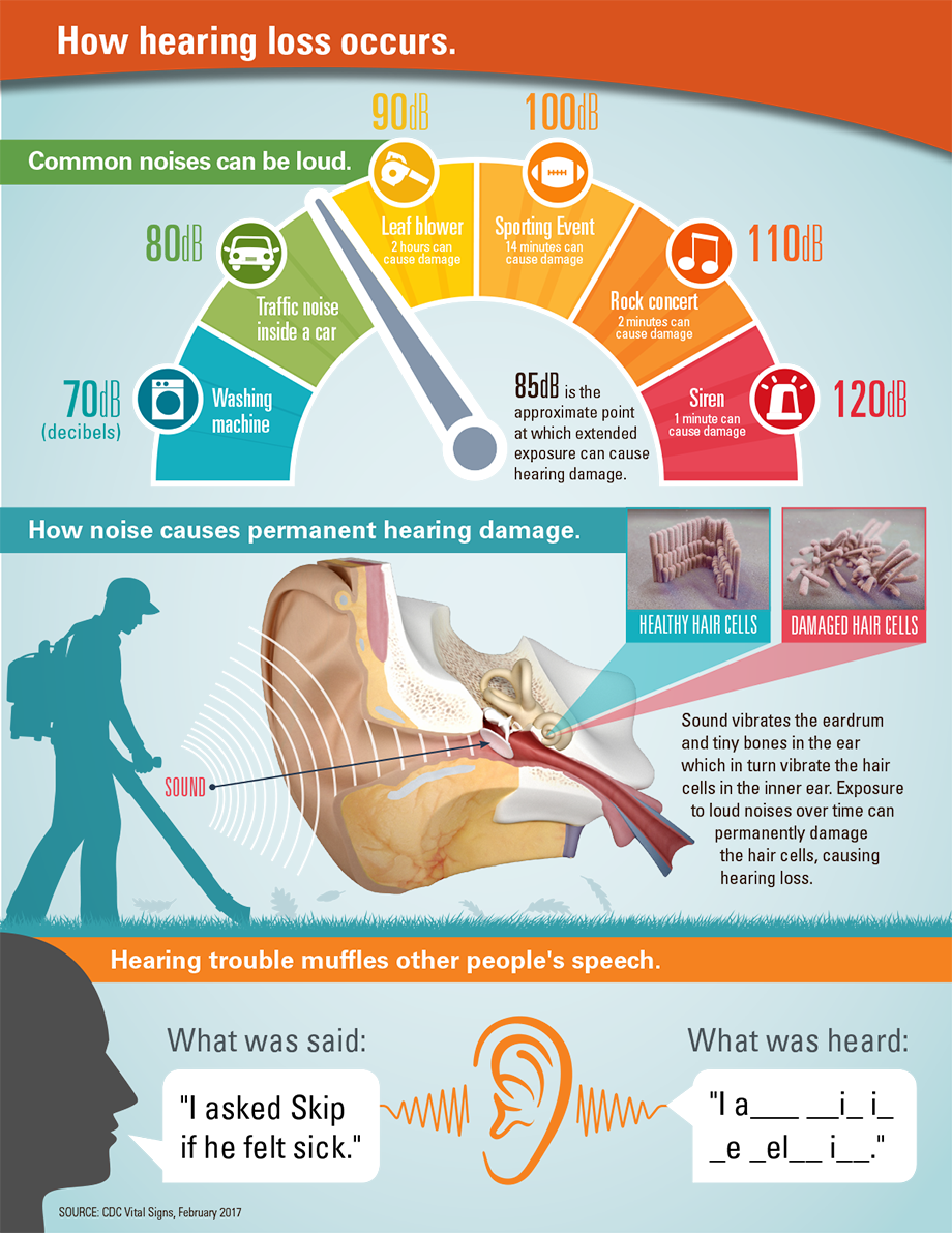 Graphic: How hearing loss occurs.