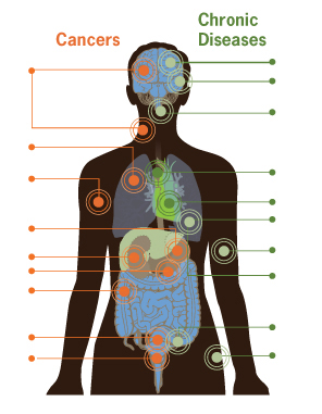 Graphic: This image is illustrates how smoking can damage every part of the body.  The image show an outline of a human body. Internal organs are visible, and circles mark the locations where smoking causes damage.  On the left side of the body, the following locations and organs are marked with circles to identify cancers caused by smoking: Head or neck, lung, stomach, kidney, pancreas, colon, cervix, and bladder.  On the right side of the body, the following locations and organs are marked with circles to identify chronic diseases caused by smoking: stroke, blindness, gum infection, aortic rupture, heart disease, pneumonia, hardening of the arteries, chronic lung disease/asthma, reduced fertility, and hip fracture. Click to view larger image.